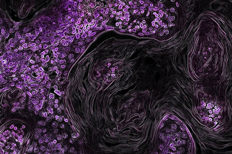 Um nova célula do sistema imunológico com capacidade para atacar tumores foi descrita por pesquisadores na revista Nature Immunology (Foto: Reprodução)