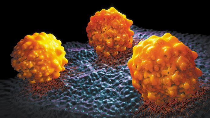 Células cancerosas: ação que bloqueia o funcionamento do sistema imunológico (Foto: iStock)