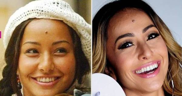 A apresentadora Sabrina Sato é uma das inúmeras celebridades que já aderiu ao procedimento