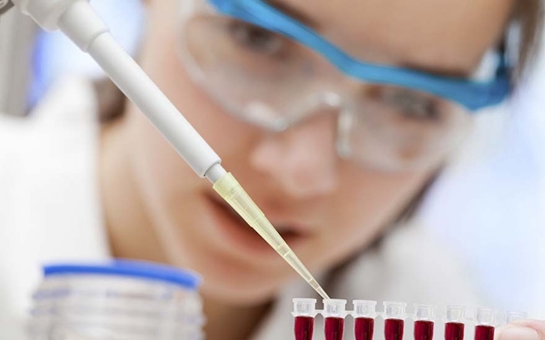 amostras foram testadas como parte de um estudo retrospectivo complementar à vigilância de sentinela da dengue (Foto Reprodução)