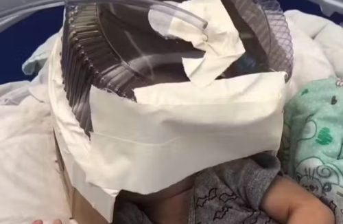 Médica age rápido e usa embalagem de bolo como máscara de oxigênio para salvar bebê - Jornal da Franca