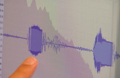 Inteligência Artificial utiliza a voz para detectar doenças neurodegenerativas - Jornal da Franca